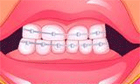 العاب علاج الاسنان